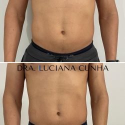 gosdura localizada (2)